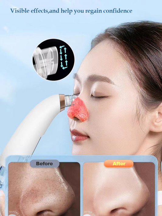 Electric Small Bubble Blackhead Remover USB Water Cycle Pore Acne Pimple Removal Vacuum Suction Facial Nose Cleaner Tool